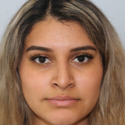 Rhinoplasty